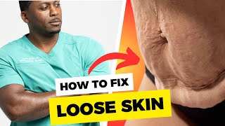 How To Fix LOOSE SKIN After Major Weight Loss [upl. by Ninnahc344]