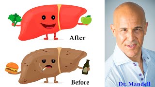 Cleanse amp Detox Liver with 1 Herb and Live a Long Health Life  Dr Alan Mandell DC [upl. by Gwennie]