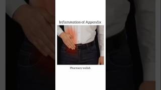 Inflammation of Appendix 🗣️   shoerts pharmacy [upl. by Kaylyn]