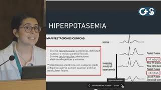 Sesión clínica Potasio como tratarlo hoy Hiperpotasemia [upl. by Yuh]