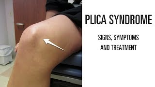 Plica syndrome Signs symptoms and treatment of this uncomfortable knee pain [upl. by Leinehtan426]