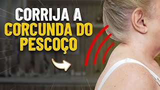 OS 3 MELHORES EXERCÍCIOS PARA A CORCUNDA DO PESCOÇO  FISIOPREV [upl. by Assedo]