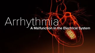 Heart Arrhythmia – Yale Medicine Explains [upl. by Anaek436]