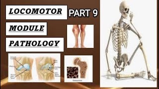 Loco pathology  Pyogenic osteomyelitis locomotor pathology bonedisease osteomyelitis [upl. by Sesylu]