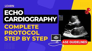 Echocardiography Standard Protocol  Step by Step  Complete Transthoracic Normal Echocardiogram [upl. by Byran]