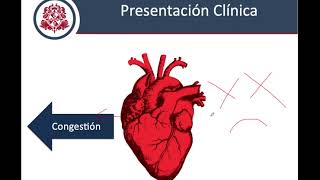 Insuficiencia Cardiaca  Fisiopatología Clínica y Diagnostico [upl. by Annyrb918]