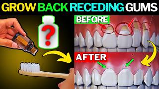 How to Regrow Receding Gums Fast Naturally [upl. by Inalaeham268]