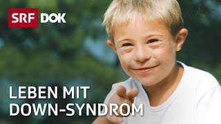 Simons Weg – Leben mit DownSyndrom  Fortsetzung folgt  Doku  SRF Dok [upl. by Reid962]