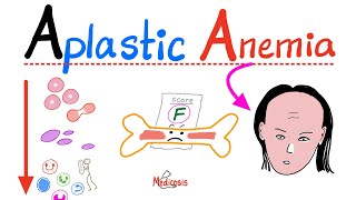 Aplastic Anemia  All you need to know  Definition Causes Symptoms Diagnosis amp Treatment [upl. by Kettie123]