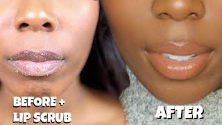 HOW TO GET SOFT PINK LIPS NATURALLY  Lighten Dark Lips [upl. by Grobe]