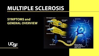 Multiple Sclerosis Symptoms and General Overview [upl. by Yssis76]