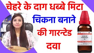 चेहरे के दाग धब्बे हटाने के लिए  chehre ke gadde kaise mitaye  chehre se pimple kaise hataye [upl. by Einafets]