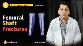 Femoral Shaft Fractures  Orthopedic Surgery  Video Lectures  VLearning [upl. by Nannie]