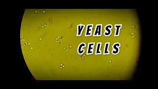 Yeast cells in stool routine Microscopy  labmedicine9265 [upl. by Anert]