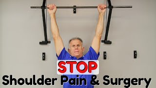 Why amp How quotHangingquot STOPS Shoulder Pain amp Surgery [upl. by Kaden428]