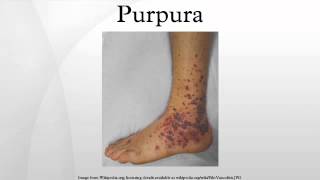 Purpura [upl. by Anrak]