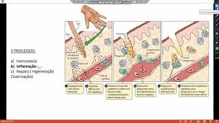 Enfermagem  PATOLOGIA  Reparo Tecidual [upl. by Litsyrk32]