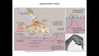 Hypocalcaemic Tetany  Neuromuscular Irritability [upl. by Niatsirt]