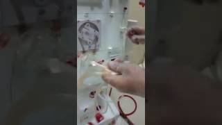 Hemodialysis Bbraun Priming part 1 [upl. by Thirion]