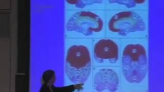 Lecture 06 Architecture of Cortex amp Going Beyond Primary Visual Cortex [upl. by Llireva347]