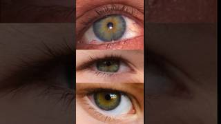 Central Heterochromia Debunked 👁️ [upl. by Gnos]