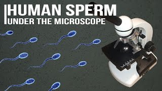 Human Sperm under the microscope [upl. by Oiratnom]