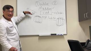 Double Maddox Rod testing [upl. by Eddie]