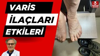 Varis İlaçları Daflon Doxium Venotrex Venoruton Sağlık ProfDrSerdar Akgün [upl. by Aiciruam596]