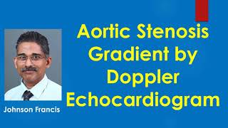 Aortic Stenosis Gradient by Doppler Echocardiogram [upl. by Elletsirhc]