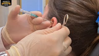 Piercing Stechen Close Up  Ganz cool mal ein Helix  Conch Piercing gestochen 💉 Marcs Piercing TV [upl. by Eedoj]