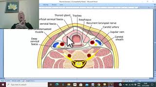 Thyroid disorders in Arabic 19  Thyroid neoplasms  pathology 2   by Dr Wahdan [upl. by Wood136]