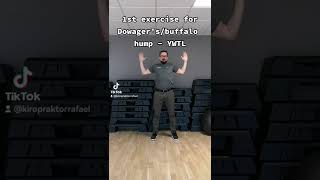 YWTL exercise for Dowagersbuffalo hump and forward head posture [upl. by Irim854]