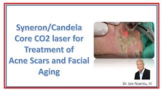 The SyneronCandela Core CO2 Laser Treatment for Acne Scars and Facial Aging [upl. by Blanch]