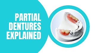 Watch this before you get a partial denture What you need to know Partials Explained [upl. by Autum]