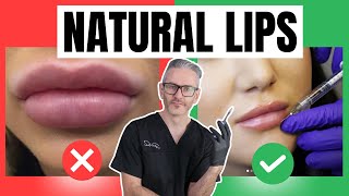 How to Create a Natural Lip Filler Result NO ONE WILL NOTICE [upl. by Atsok]