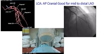 Cardiology Review 2024 part 5  presentation slides [upl. by Ahsyak]