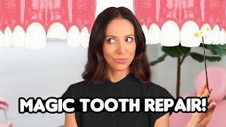 What is Tooth Bonding Magic [upl. by Alexandra]