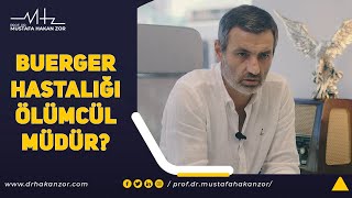 Buerger Hastalığı Ölümcül müdür  Buerger Hastalığı Tedavisi var mı [upl. by Suzzy8]