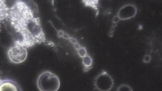 LIVE BLOOD CELL ANALYSIS WHITE BLOOD CELLS vs BACTERIA [upl. by Anytsirhc]