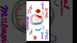 Mnemonic for Extradural hematoma vs Subdural hematoma for USMLE PLAB FCPS Medicine shorts viral [upl. by Pentheam]