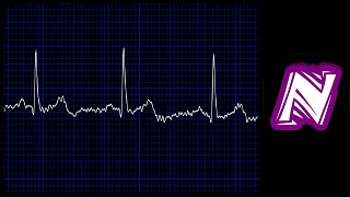 Sonido de monitor cardiaco  Heart monitor sound effect  Ekg sound  Sonido electrocardiograma [upl. by Seerdi]