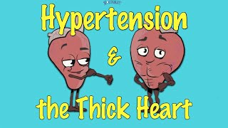 Left Ventricular Hypertrophy LVH and Hypertension [upl. by Nylyoj]