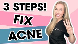 3 Steps To Fix Your Acne WITHOUT A Prescription  Skincare Made Simple by The Budget Dermatologist [upl. by Egon]