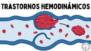 TRASTORNOS HEMODINÁMICOS Hiperemia Congestión Edema Efusión Hemostasia Trombosis y Embolismo [upl. by Devin]