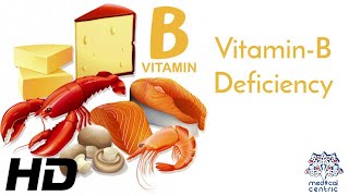 Vitamin B Deficiency Everything You Need To Know [upl. by Adyht]