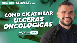 Como CICATRIZAR um ÚLCERA ONCOLOGICA 2x mais rapido  VIDEO AULA 104 [upl. by Geraldina149]