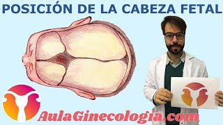 POSICIÓN de la CABEZA FETAL durante el PARTO  Ginecología y Obstetricia [upl. by Haela]