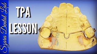 How to make a Transpalatal Arch TPA Orthodontic appliance by Szara [upl. by Vitus]