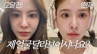 SUB Vlog  얼굴이 달라진 이유  쥬베룩 볼륨 후기  콜라겐주사👼🏻  쇼핑 하울🛍️  미드 보며 영어공부 하는 법  시티브리즈 모델👗 테라스에서 가을 만끽🍁 [upl. by Ebby]