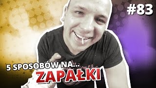 5 sposobów na ZAPAŁKI [upl. by Staffan]